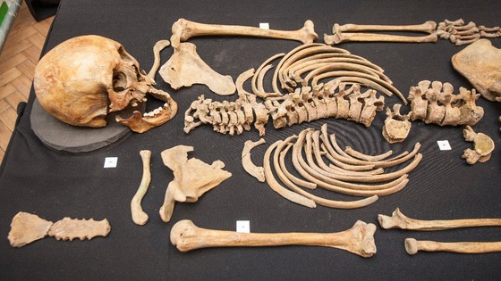 Human bones.