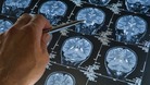Prime Minister on dementia funding