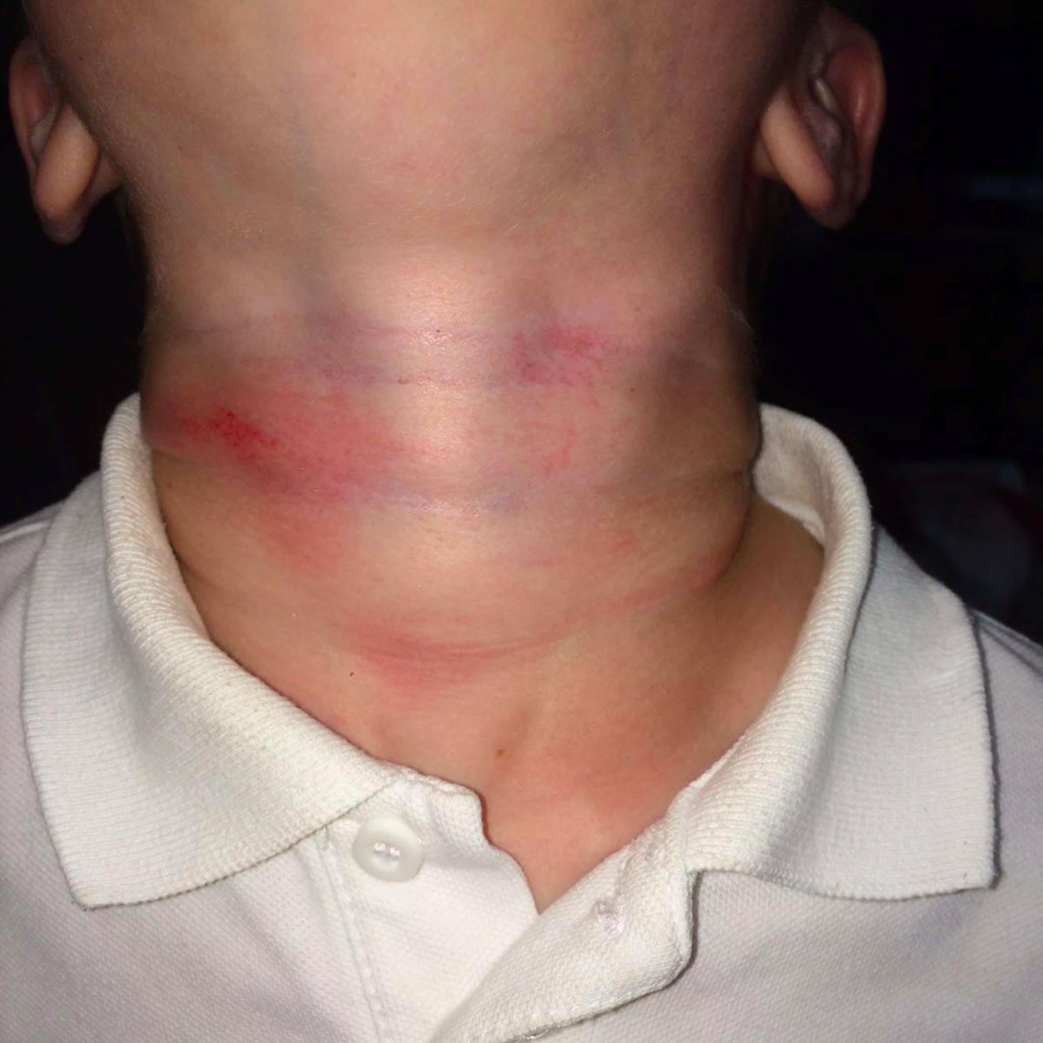Boy injured after 'skipping rope strangling' at school Central ITV News