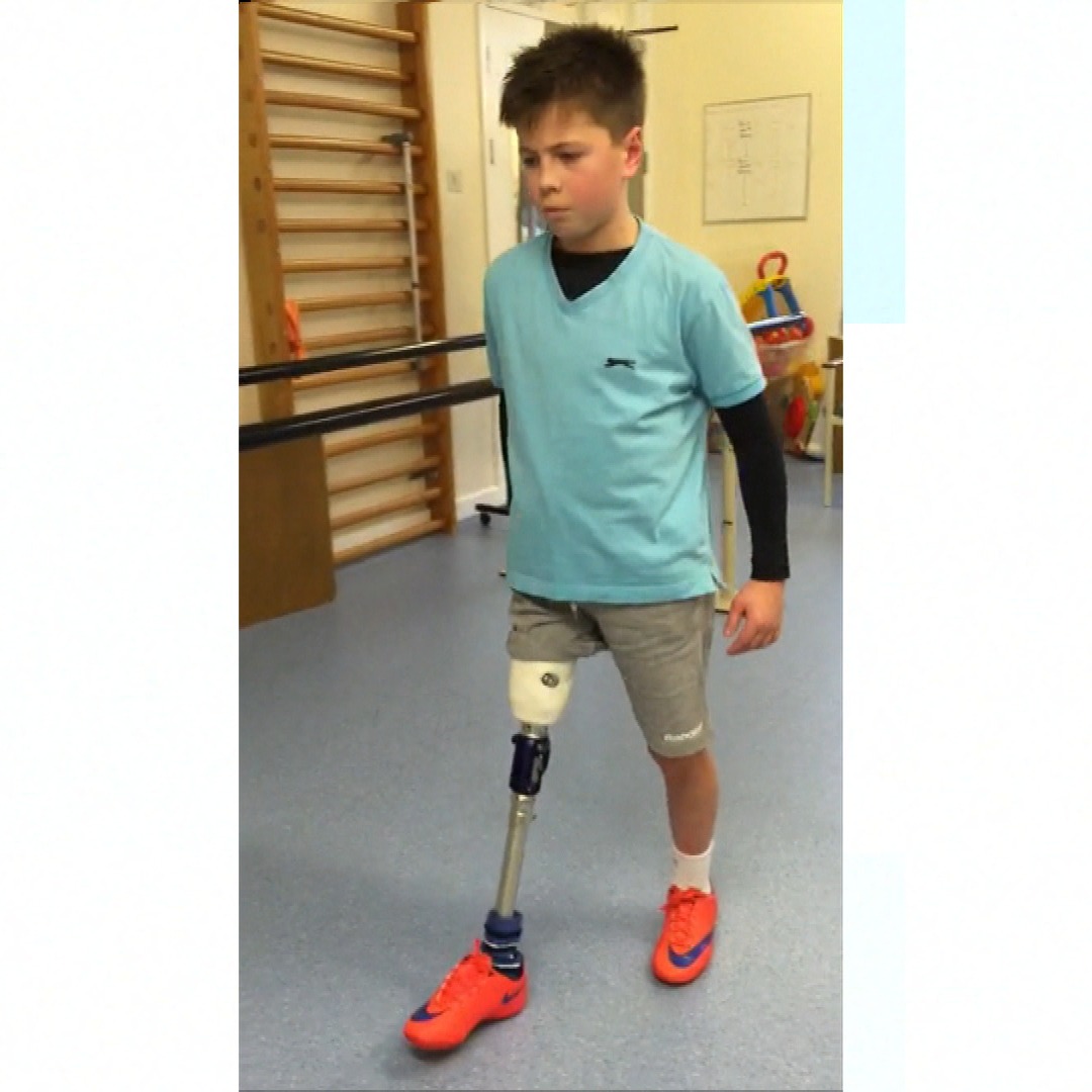 Call for better safety rules after boy loses leg falling from coach