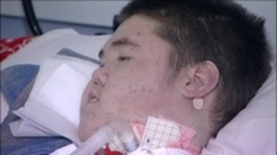 Liam Barker has defied the odds by surviving to his 18th birthday.