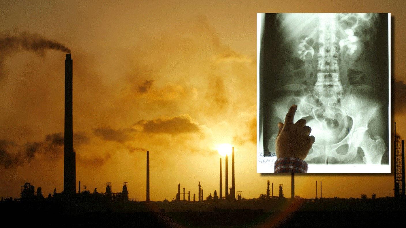 Pollution, gadgets and burnt food linked to 40% surge in childhood cancer rates - ITV News