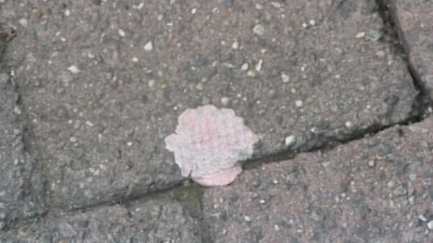 Gum