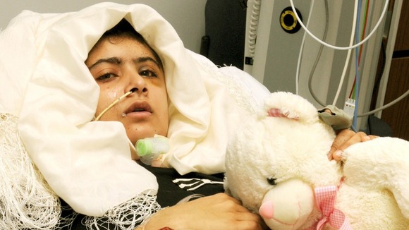 Malala Yousufzai, pictured with gunshot wounds to the head in the Queen Elizabeth Hospital in Birmingham.