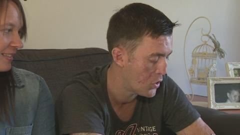 Bionic hand for Nottingham man after fundraising success - ITV News