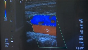 Dumfries and Galloway Infirmary gets new lab