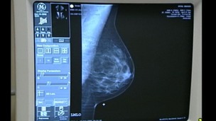 Breast cancer screenings.