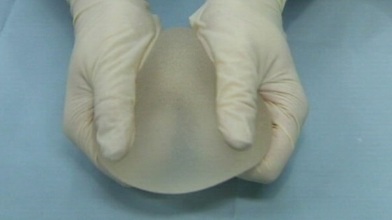 PIP implant 