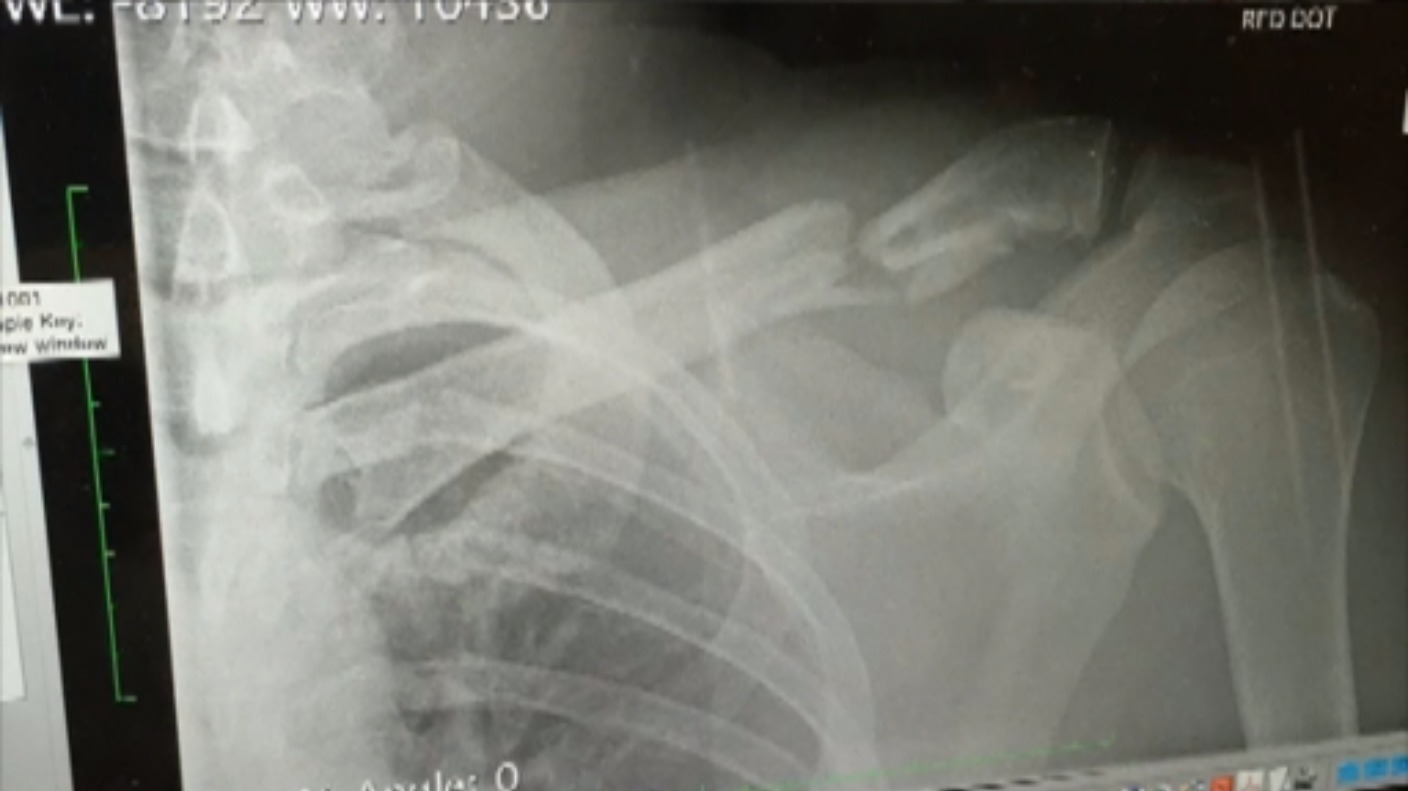 BMX rider reveals he will contest next Olympics despite 'nightmare' crash - ITV News