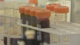Cambridge University drug could help those with MS