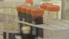 Cambridge University drug could help those with MS