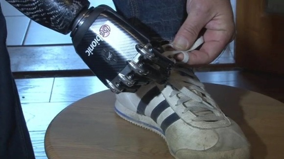 The bionic arm responds to muscle twitches