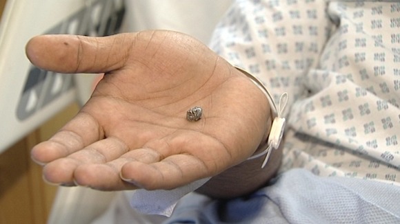 The bullet deformed as it embedded itself into Ummad Farooq's skull