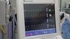 Kidney Operation