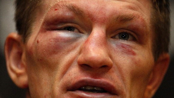 Ricky Hatton