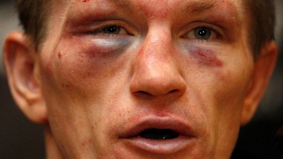 A dejected Hatton addresses the media after the fight.