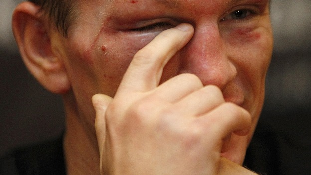 A teary eyed Hatton announced his retirement during the post-fight press conference.