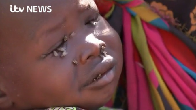 Children in South Sudan are starving