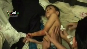 A young boy was among those injured by the bomb 