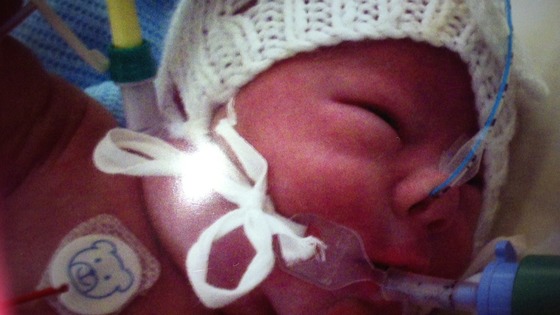 Abigail in hospital 