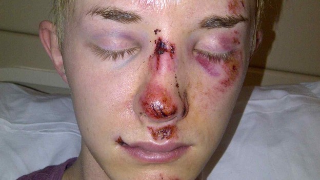 Photographs have been released showing the extensive injuries he suffered to his face