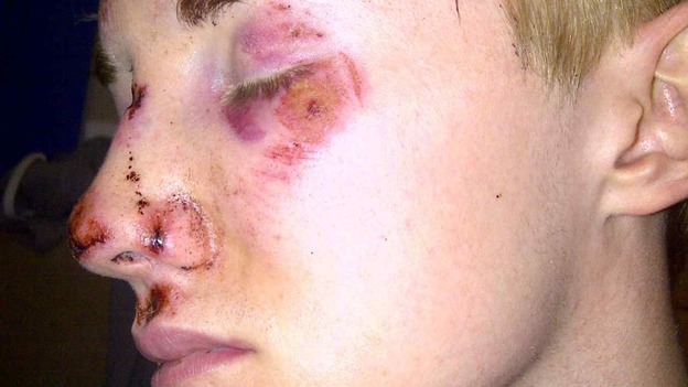 Photographs show the extensive bruising, cuts and grazes he suffered to his face