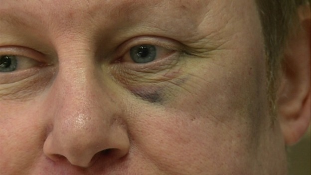 Jeweller, David Nicholls sustained a black eye in the robbery