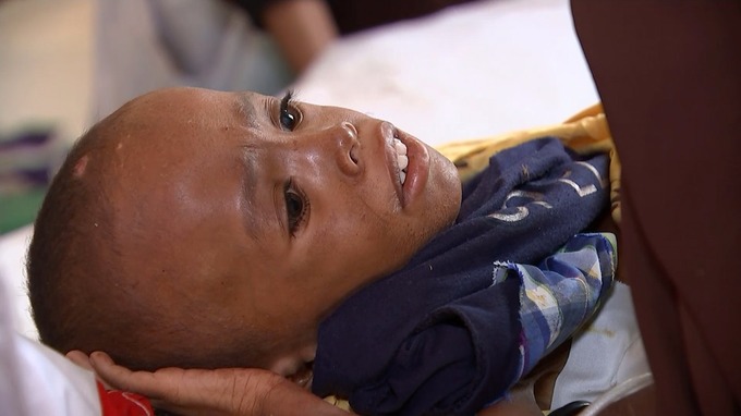 No one knows if or when Mohammed will get better.