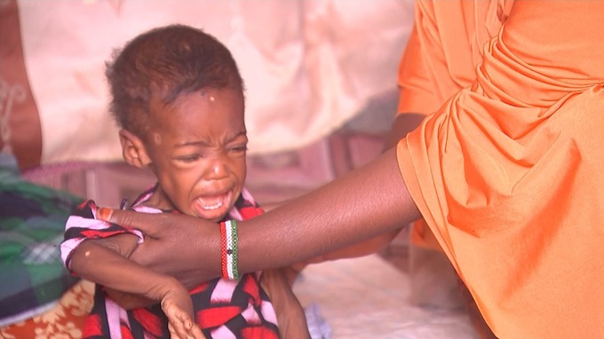 One-year-old Sameera is one of the youngest to contract cholera.