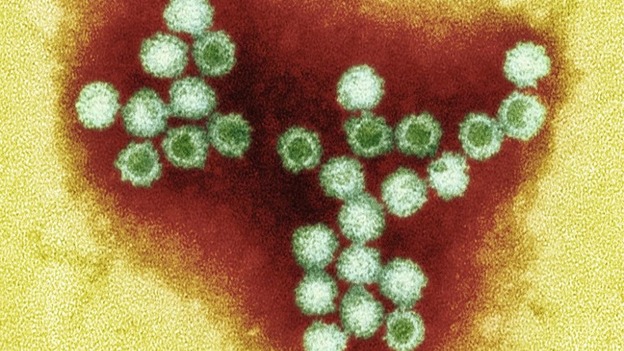 There have been more cases of winter vomiting bug norovirus during 2012.
