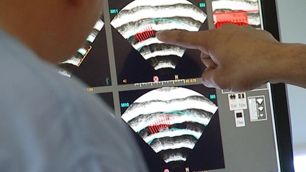 Research into the most common cancer in the UK is 'chronically underfunded' compared with its female equivalent. 