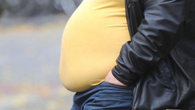 The Royal College of Physicians said the NHS must adapt to meet the needs of bulging Britain. 