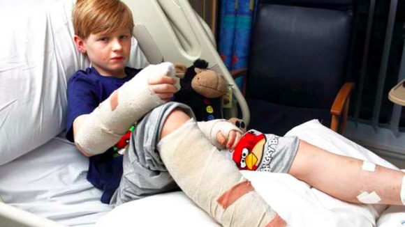 12 year old Louis was taken to hospital where he had treatment for serious bite wounds to his leg