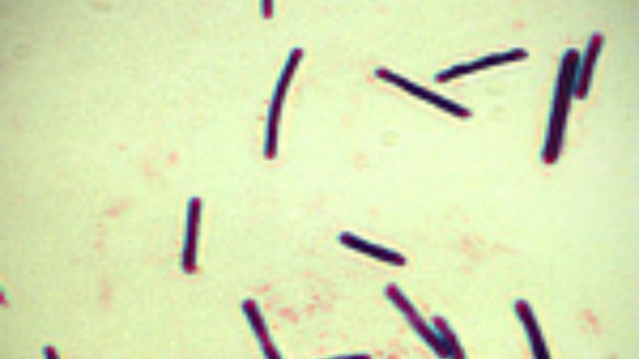 Clostridium perfringens.