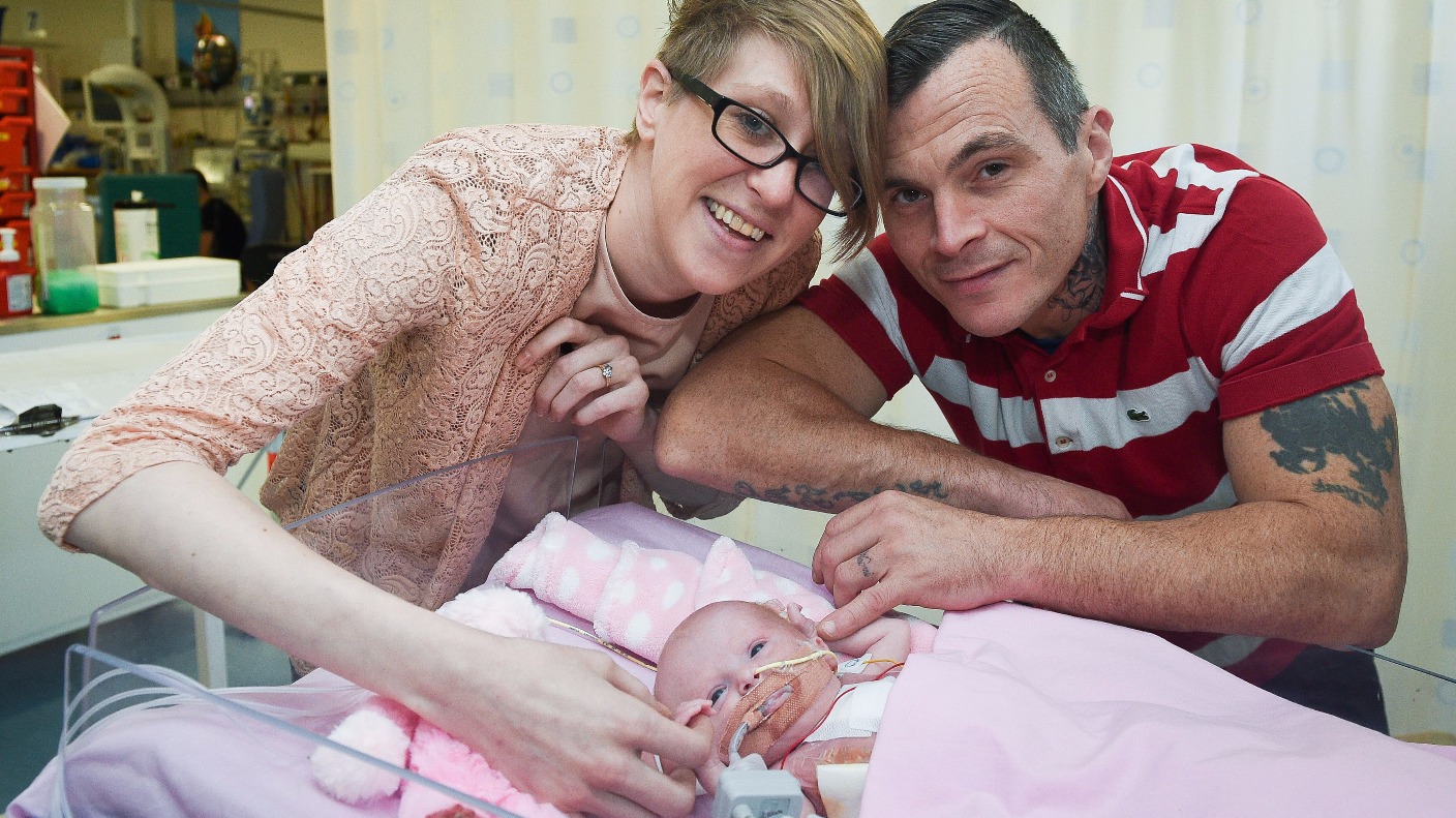 Vanellope Hope Wilkins Baby Born With Heart Outside Body First In UK