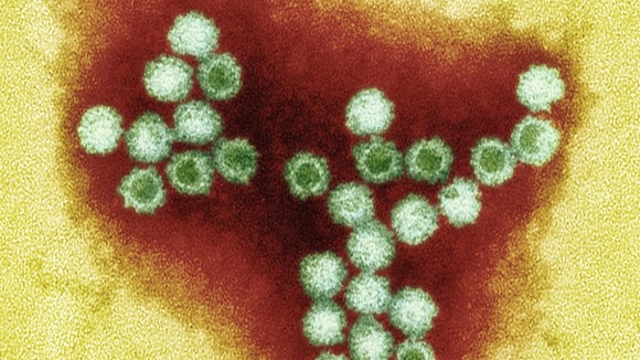 Norovirus