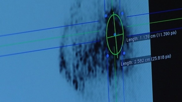 Doctors can use detailed images from the scanner to analyse the tumour