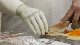 A silicone socket, attaches the hand to Mr Taylor's arm