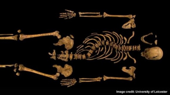 The complete remains of Richard III, above, show the monarch had a curvature of the spine.
