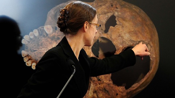 Dr Jo Appleby show how the skull of King Richard III had been damaged in battle.