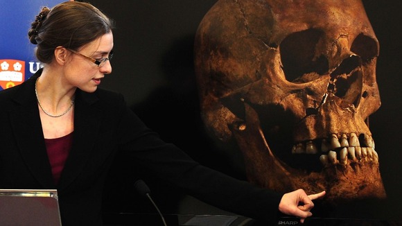 Jo Appleby, a lecturer in Human Bioarchaeology points to details of the King's skull
