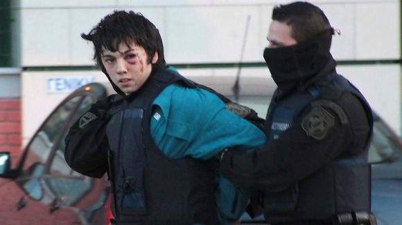 A shot of one of the suspects shows a large purple bruise and a cut under the left eye
