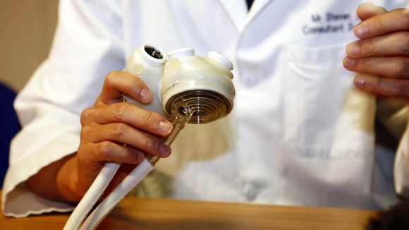 A Total Artificial Heart at Papworth Hospital where patient Matthew Green became the first person in the UK to receive one