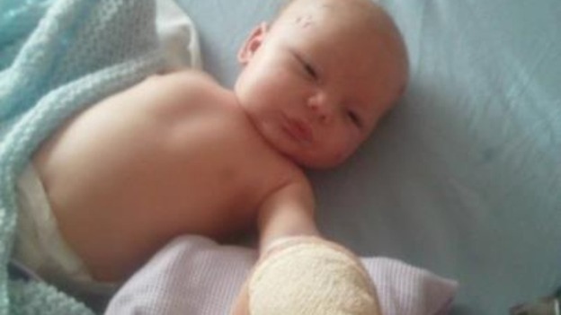 A fox attacked the baby as slept in his cot.