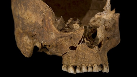Skull
