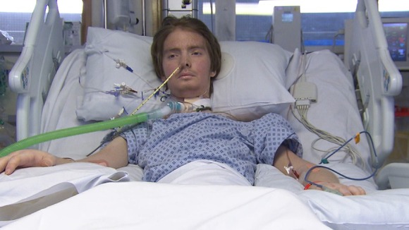 Young man in intensive care