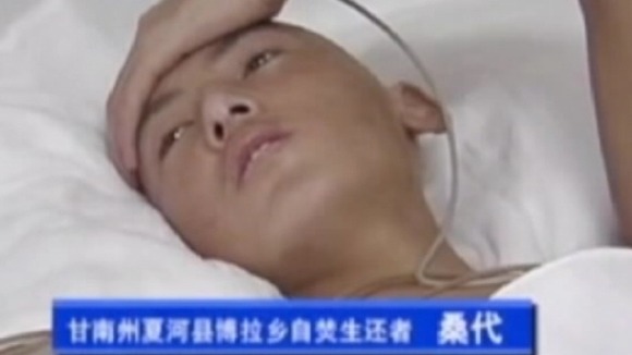 A survivor of self-immolation is interviewed on Chinese state TV