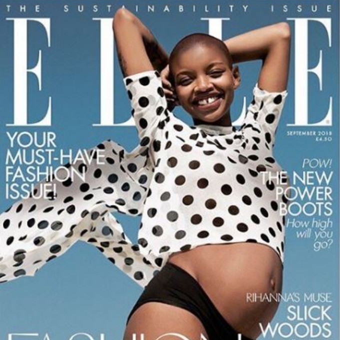 Model Slick Rogers is the face of Elle's September issue.