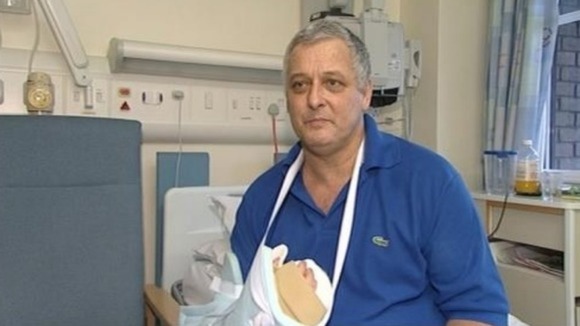 Mark Cahill with his new hand following the operation
