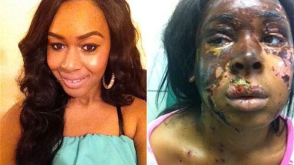 Naomi Oni suffered serious facial injuries in the incident.